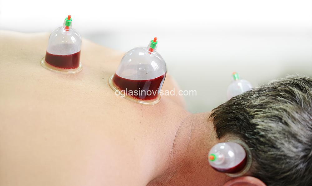 cupping_1-small_wet